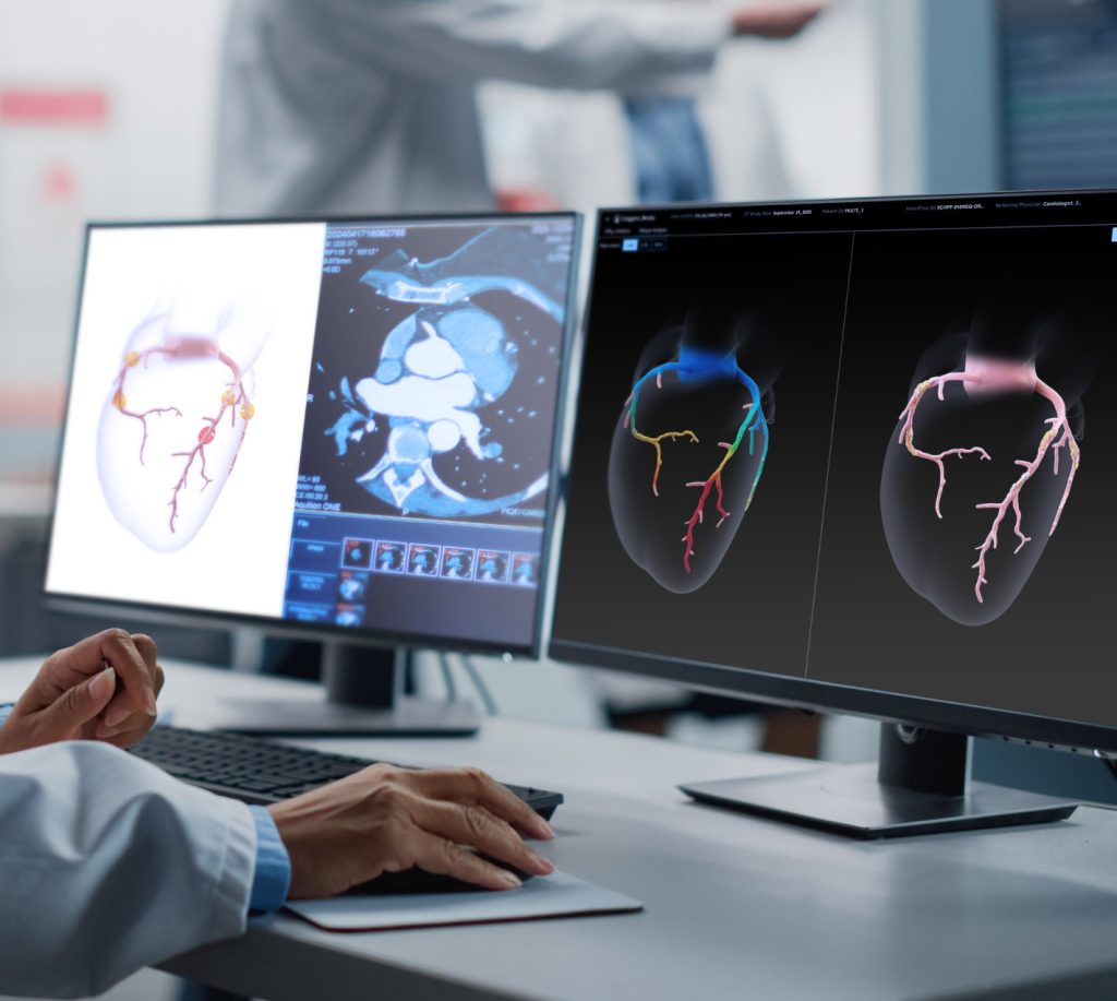 Heartflow Analysis: 3D Heart Imaging from MyCardiologist