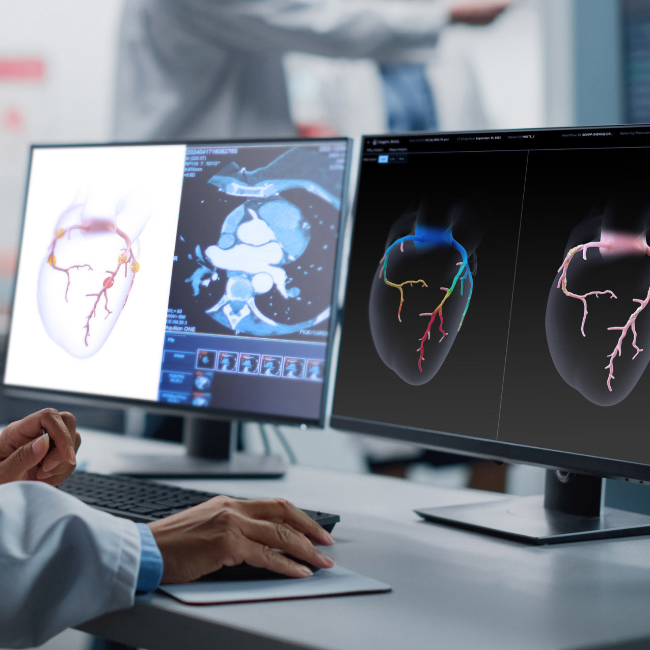 Heartflow Analysis: 3D Cardiac Imaging