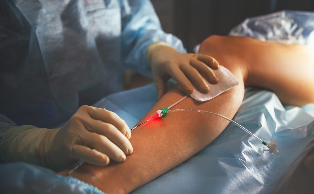 Miami Vericose Vein and Vascular Treatment from MyCardiologist
