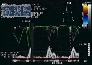 South Miami Echocardiogram